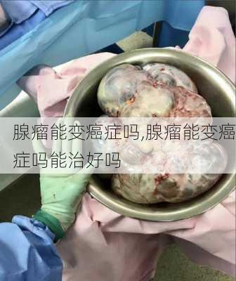 腺瘤能变癌症吗,腺瘤能变癌症吗能治好吗